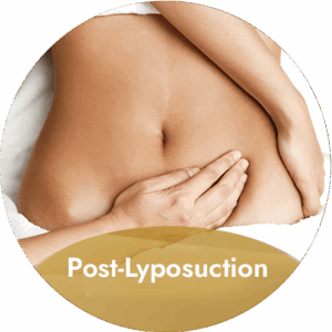 Post-Liposuction Massage
